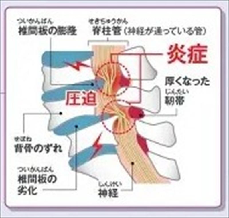 実際の施術体験