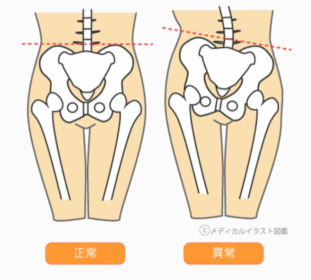 顔の歪みの原因と影響
