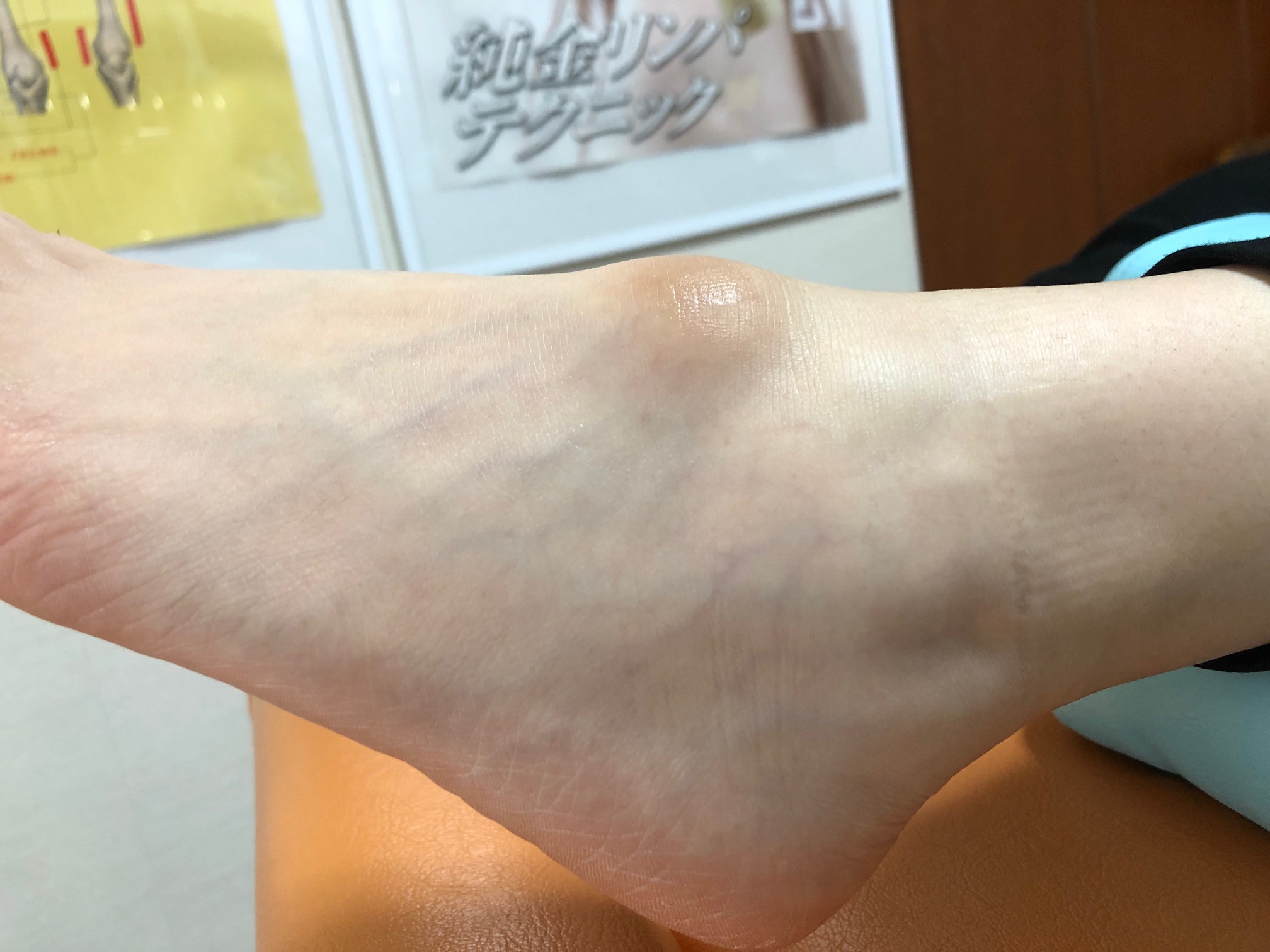 痛くない施術で新しいあなたへ。越谷のガングリオンケア専門サロンで健康を手に入れよう！