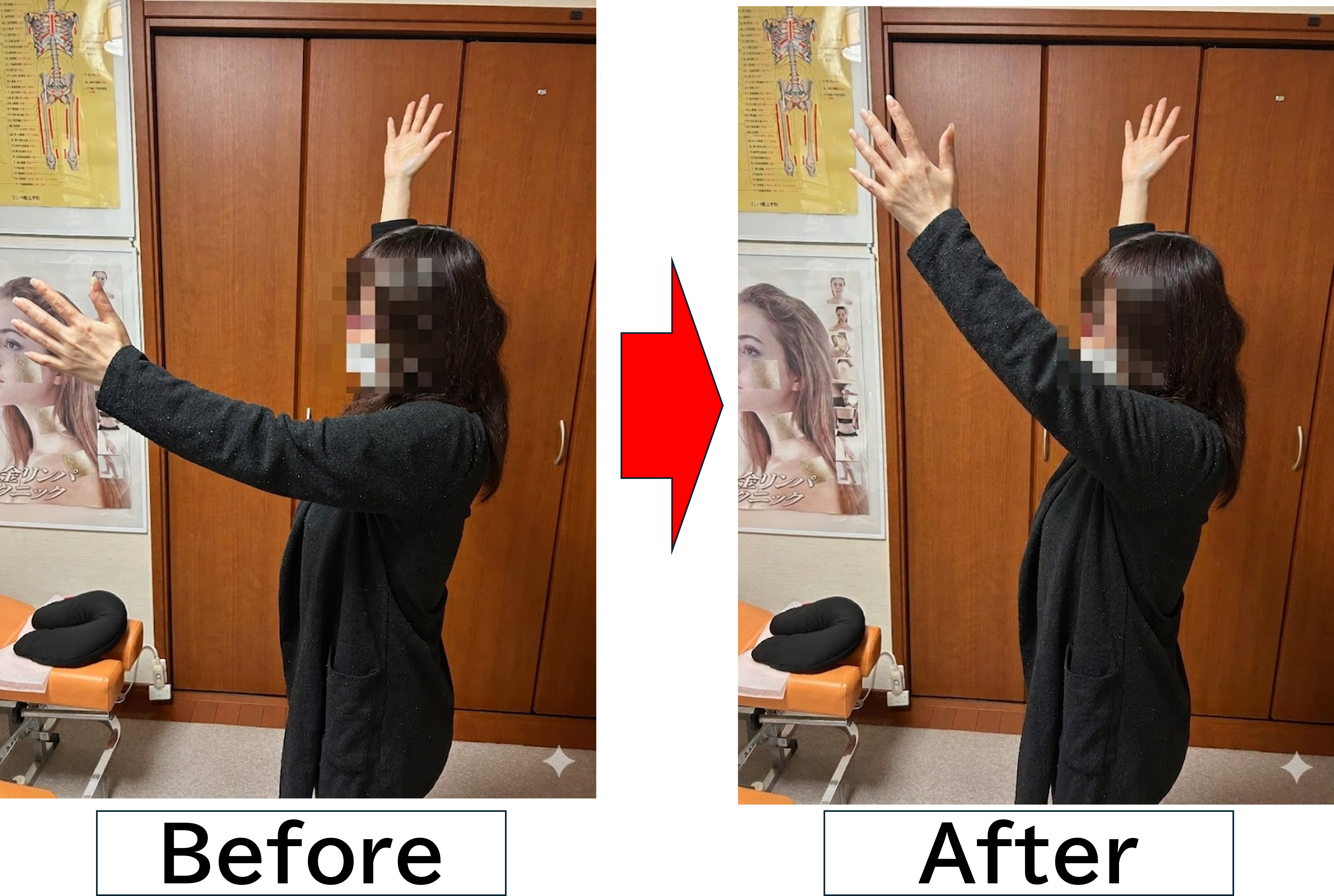施術後のアフターケア